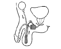 diagram showing the process described