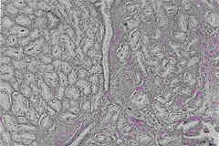 photo of pathology slide