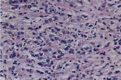 photo of pathology slide