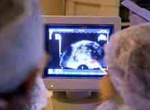 video screen of sonogram with surgeons watching