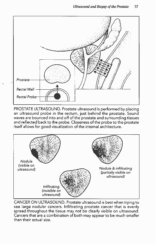 scan of page 57 of Sheldon Marks book Prostate and Cancer