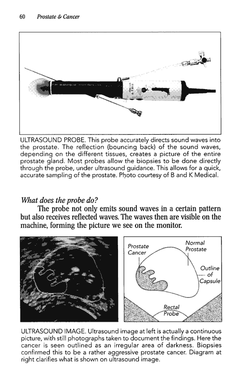 scan of page 60 of Sheldon Marks book Prostate and Cancer