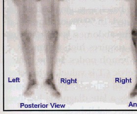 portion of image