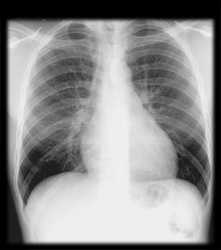 an xray of the chest