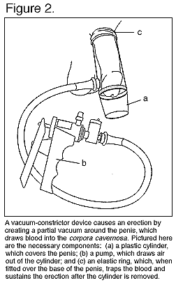 line drawing of a V E D 